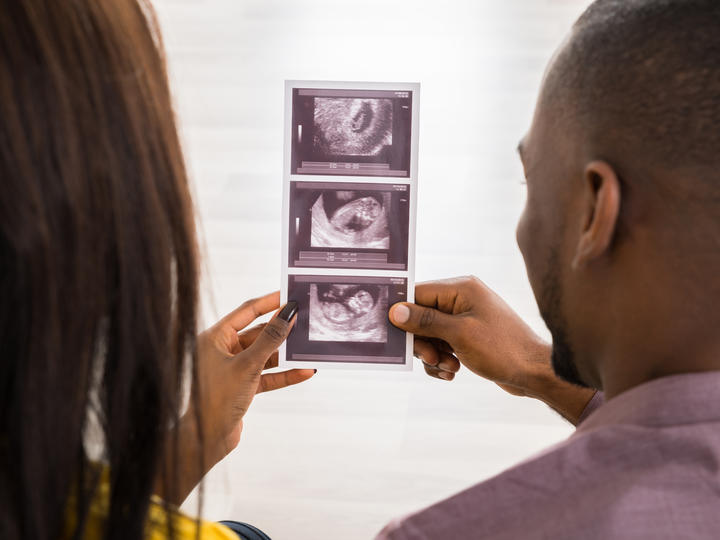 couple viewing ultrasound