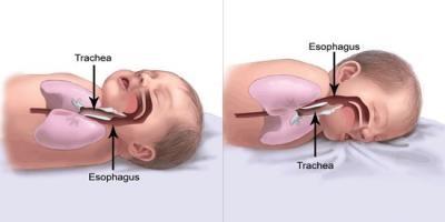 baby diagram