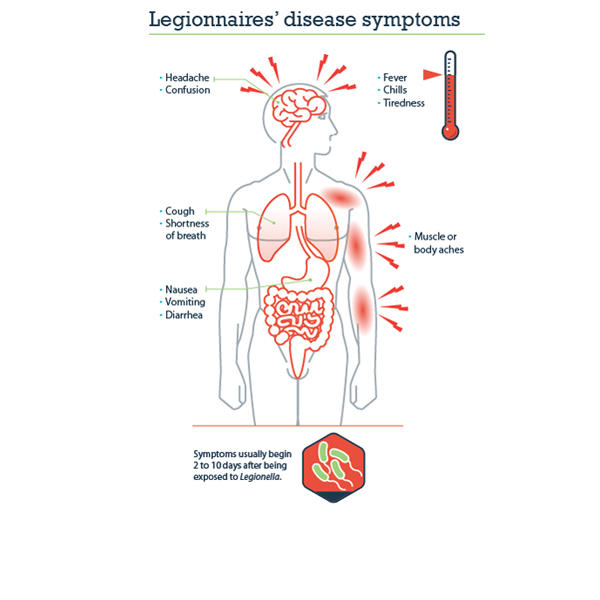Legionnaires' disease symptoms