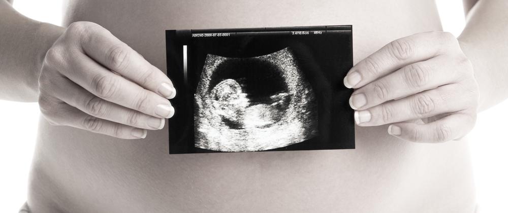 woman holding sonogram