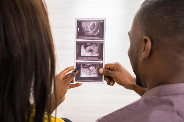 couple viewing ultrasound