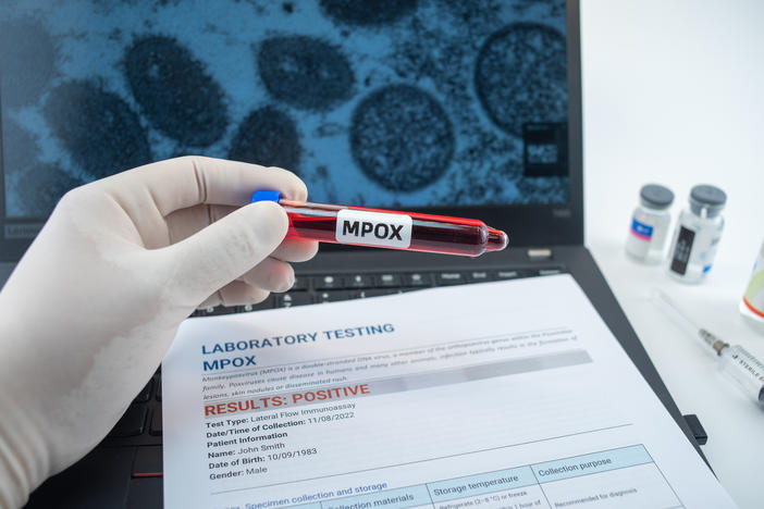mpox testing